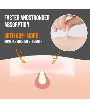 AUSLKA Large Blemish Pimple Patches (20 Strips) - Hydrocolloid Spot Dots for Blemishes - XL Ultra Thin 20 Count - Buy Online on SooperMarket.com
