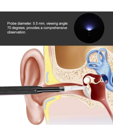 Earwax Removal Kit with Camera | Home Ear Cleaning Tool - Buy Online on SooperMarket.com