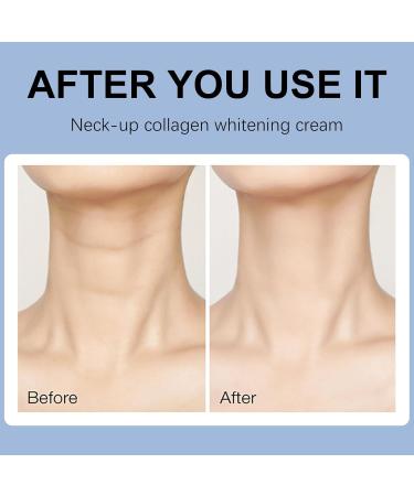 Funnaura Neck Firming Cream Collagen Tightening Lifting Sagging Skin Reduce Wrinkles Smoothing Neck Fine Liines (20g) - Buy Online on SooperMarket.com