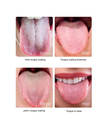 Probiotic Tongue Cleaning Gel Set with Tongue Scraper and Brush Kit - Mint Flavor | Oral Hygiene Brush and Tongue Cleaner Set - Buy Online on SooperMarket.com