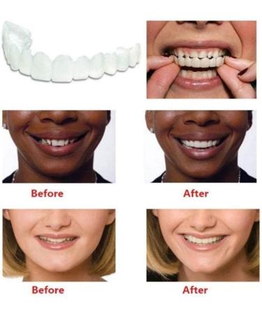 Fake Teeth Veneers Dentures - Cosmetic Tooth Repair Kit for Men and Women | Protect Your Teeth and Regain Confidence - Buy Online on SooperMarket.com