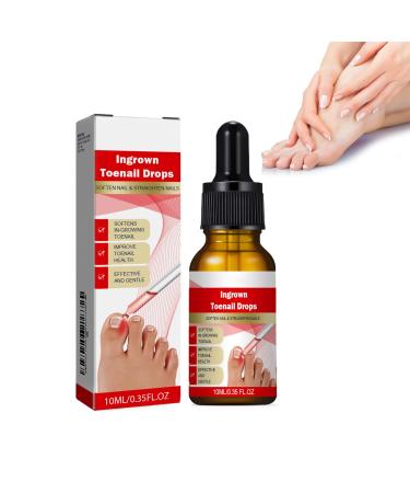 Ingrown Toenail Treatment Drop Ingrown Toenail Treatment Ingrowth Toenail Correction Treatment Oil Correction Ingrown Toenail Drops Cuticle Care Oils For Ingrown Toenails Fungal Toenail Treatment