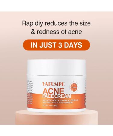 Salicylic Acid Acne Treatment Cream for Face & Body - Teens & Adults | Anti-Acne Moisturizer & Spot Treatment - Buy Online on SooperMarket.com