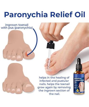 3Pcs German Toenailcare Removal Paronychia Oil for Healthier Toenails - Buy Online on SooperMarket.com