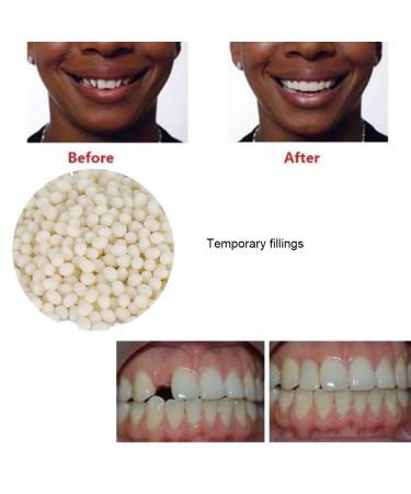 2pcs 50g False Teeth Solid Glue Kit - Temporary Tooth Replacement & Repair Adhesive - Buy Online on SooperMarket.com