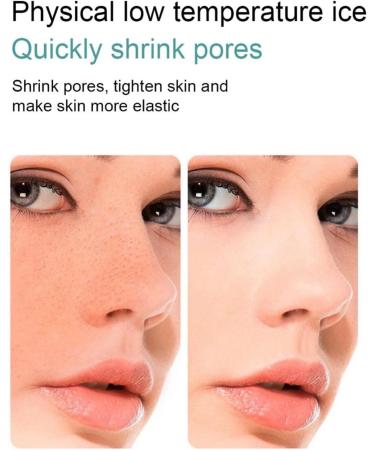 Skincare Tools: Green Stripe Face Massager Roller & Cooling Ice Tray for Pore Shrinking & Skin Tightening - Buy Online on SooperMarket.com