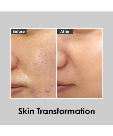MEDI-PEEL Aqua Essence Peptide 9 Toner 8.45 fl oz | Anti-Aging Collagen Firming Toner - Korean Skincare for All Skin Types - Buy Online on SooperMarket.com