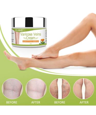 Varicose Vein Cream for Legs - Enhance Blood Circulation Reduce Spider Veins & Relieve Heavy Legs | Buy Now - Buy Online on SooperMarket.com
