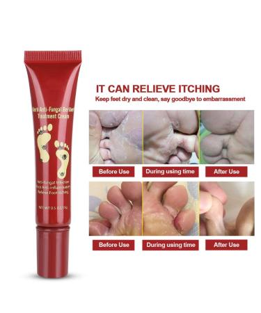 Crema para el Tratamiento de los Pies 15g | Hidratante Natural para Aliviar Hongos y Picaz n | Cuidado Efectivo para Plantas - Buy Online on SooperMarket.com