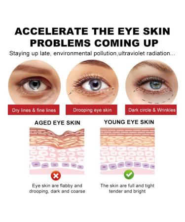 Premium Anti-Aging Eye Cream for Dark Circles Puffiness & Wrinkles - Hydrating Under Eye Treatment for Sensitive Skin - 1.7 OZ - Buy Online on SooperMarket.com