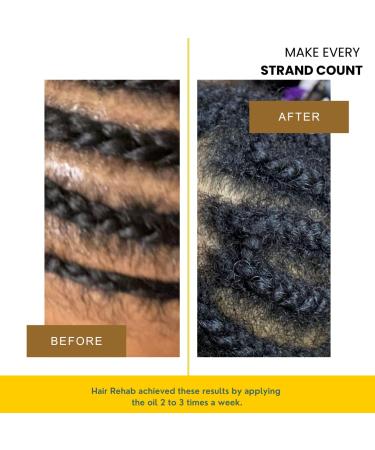 Keauty Lifestyle Hair Rehab Hair Growth Oil - Stimulates Hair Follicles for Stronger, Thicker & Healthier Hair - 10 Essential Natural Oils - Proven Results - 24 Fl Oz - Buy Online on SooperMarket.com