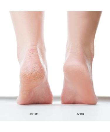 Londontown Pedicur Foot Balm Nourishing Foot Care for Soft Smooth Skin | International Shipping Available - Buy Online on SooperMarket.com