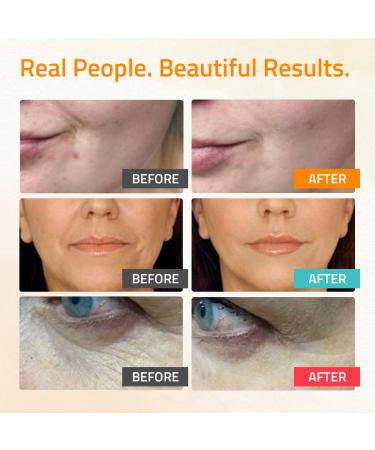 Retinol Face Serum with Vitamin C, Hyaluronic Acid - Anti-Aging & Hydrating Women's Face Serum - YEOUTH 3x1 fl - Buy Online on SooperMarket.com