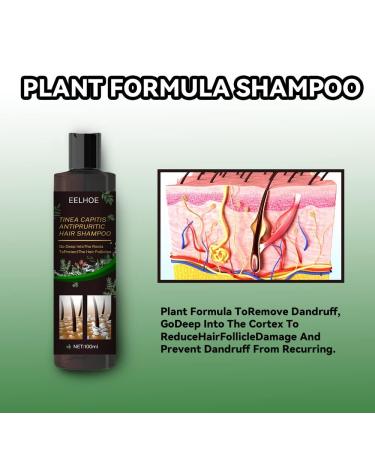 Eczema Psoriasis Anti Dandruff Shampoo for Soothing Dry, Itchy Scalp (200ml) - Buy Online on SooperMarket.com