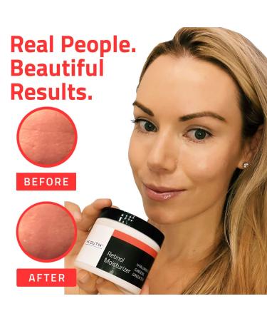Yeouth Retinol Face Moisturizer with Hyaluronic Acid - Anti Aging Night Cream for Wrinkles & Dark Spots - 4 oz - Facial Skincare for Women & Men - Buy Online on SooperMarket.com