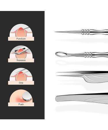 BEZOX Blackhead Tweezer and Acne Needle Set - Stainless Steel Comedone Extractor Kit - Buy Online on SooperMarket.com