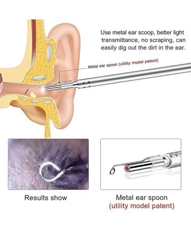 Jteremy 3.9mm HD WiFi Ear Endoscope for Ear Wax Removal - Visual Inspection Camera with LED Lights for Kids, Adults, Pets - Buy Online on SooperMarket.com