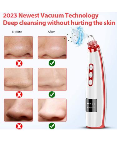 2023 Blackhead Remover Pore Vacuum - Upgraded Electric Facial Cleaner with 5 Suction Power Probes - USB Rechargeable Blackhead Vacuum Kit for Women & Men - Buy Online on SooperMarket.com