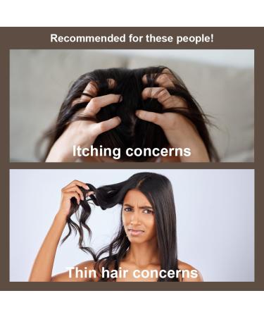 Buy Naisture Red Ginseng 3X Premium Golden Shampoo 24.68oz - Revitalize All Hair Types Soothes Itchy Scalp & Strengthens Thinning Hair - International Shipping Available - Buy Online on SooperMarket.com
