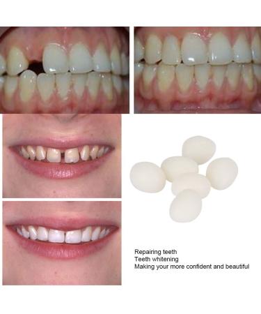2pcs 50g False Teeth Solid Glue Kit - Temporary Tooth Replacement & Repair Adhesive - Buy Online on SooperMarket.com