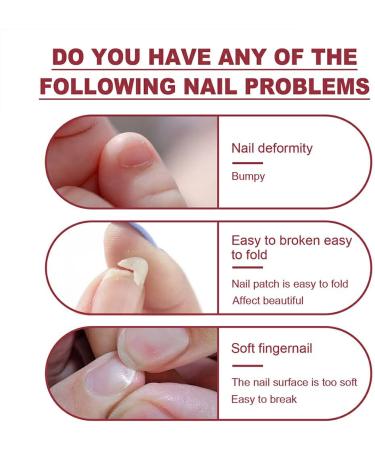 Dajidafu Nails Repairing Extension Gel Portable Fingernail Manicure Pedicure Polish Accessory for Household Professional Salons - Buy Online on SooperMarket.com
