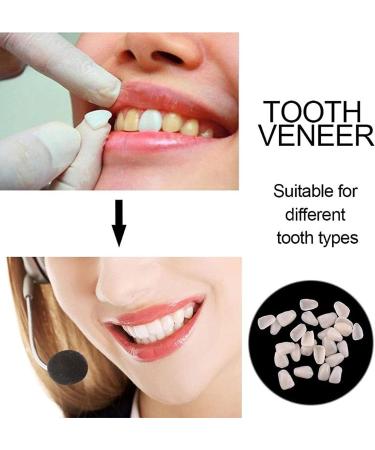Snap on Smile Braces Instant Perfect Smile Temporary Replacement Tooth Kit for Broken Missing Teeth - Buy Online on SooperMarket.com