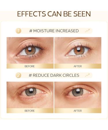 Snail Eye Patches 50 Pieces Moisturizing Golden Eye Masks Skin Care for Dark Circles Puffy Eyes Eye Bags Under Eyes with Caffeine & Hyaluronic Acid - Buy Online on SooperMarket.com
