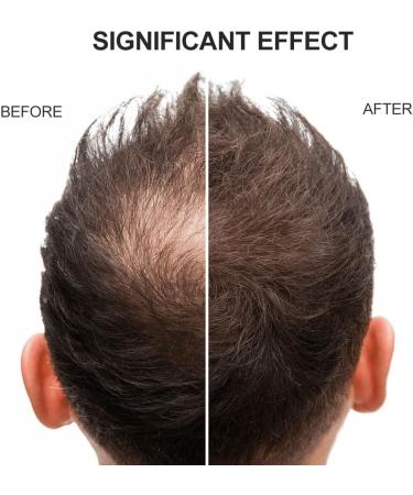 Hair Building Fibers Hair Building Fibres Powder Hair Fibres Dark Brown Hair Fibres For Thinning Hair Hair Loss Concealer Fiber Hair Building Fibres & Hair Fibers (Dark Brown) - Buy Online on SooperMarket.com