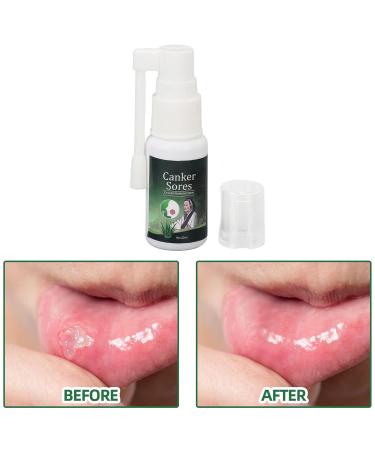 Mundspray - Ultimate Oral Ulcer Relief Bad Breath Reduction Dry Mouth Treatment & Gum Protection | Shop Now! - Buy Online on SooperMarket.com
