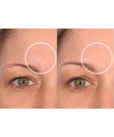 SiO Beauty BrowLift Forehead Anti-Wrinkle Patch - Rapid Overnight Reusable Silicone Patch to Reduce Furrows Expression Lines and Creases - Buy Online on SooperMarket.com