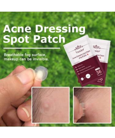 Acne Dressing Spot Patch Acne Paste Transparent Pimple Patch Breathable Painless Acne Treatment Gel Patch Skin Care Absorb Pus Rapid Healing Effective Antibacterial Protection 36 Patches - Buy Online on SooperMarket.com