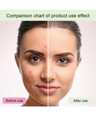Glycolic Acid 7% Toning Solution Glycolic Acid Toner Glycolic Acid 7% Toning Resurfacing Solution Moisturize & Strengthen Skin Exfoliating Glycolic Acid 7% Toning Solution - Buy Online on SooperMarket.com