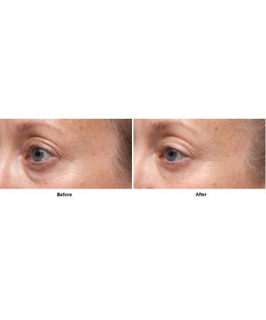 Dr. Dennis Gross Ferulic + Retinol Triple Correction Eye Serum 0.5 fl oz - Targets Wrinkles, Elasticity Loss, Rough Texture - (Pack of 1) - Buy Online on SooperMarket.com