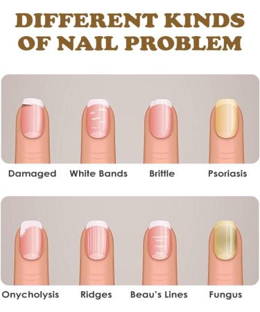 NailGrowth DeepHealing Organic Serum NailGrowth Serum Reconstrux Nail Growth Nail Growth and Strength Serum Nail Growth Serum Nail Repair Essence Serum 30ml (3Pcs) - Buy Online on SooperMarket.com