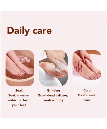 Electric Feet Callus Remover with 360 Head 3 Grinding Heads Ambient Lighting for Dead Hard Skin Pedicure Tool for Dry Feet Rechargeable Portable Electronic Foot File - Buy Online on SooperMarket.com