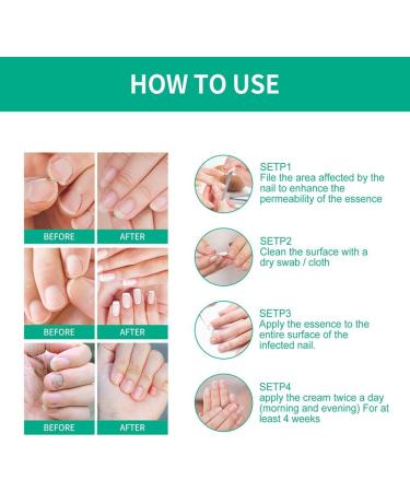 Nail Fungus Removal Liquid - Natural Toenail Fungus Oil for Effective Nail Care | BTSEURY - Buy Online on SooperMarket.com