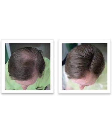 Caboki Hair Loss Concealer Hair Building Fiber 25g (Black) - Buy Online on SooperMarket.com