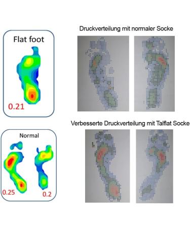 Inook Talflat Correction Socks - Relieve Foot Pain Flat Feet & Hallux Valgus | kotex Splint 43 Black - International Shipping Available - Buy Online on SooperMarket.com