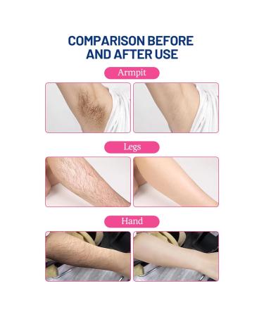 20 Wax Strips for Hair Removal - Gentle & Safe Deep-Cleaning Wax for Dry Skin - Perfect for Home Use - Buy Online on SooperMarket.com