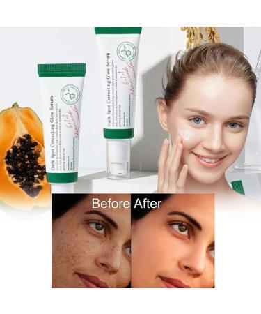 Facial Black Spot Remover Cream Facial Correction Cream Nicotinamide Facial Essence Skin Repair for Lightening Sunburn and Acne Marks Lightening Pigmentation and Rapidly Improving Skin Color 50 ml - Buy Online on SooperMarket.com