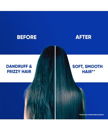 Buy Head & Shoulders Smooth and Silky 2-in-1 Anti Dandruff Shampoo + Conditioner 180ml | International Shipping Available - Buy Online on SooperMarket.com