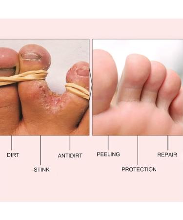 Feet Foot Repairing Cream - Moisturizing Balm for Dry Cracked Heels | 15g/0.53oz - Best Remedy for Dry Feet - Buy Online on SooperMarket.com