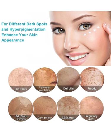 Fast-Acting Dark Spot Remover for Face & Body | Hyperpigmentation & Melasma Corrector | Even Skin Tone | Age Spot Treatment for Men & Women - Buy Online on SooperMarket.com