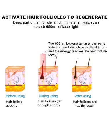 Laser Hair Growth Device - 180 Light Chips for Enhanced Hair Growth (Gray) | International Shipping Available - Buy Online on SooperMarket.com