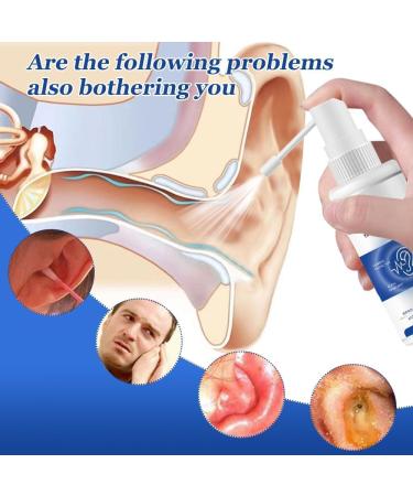 Fengyang Relief of Tinnitus Tinnitus Spray Tinnitus Relief for Ringing Ears Spray Ear Tinnitus Relief for Relieves Tinnitus Relieves Tinnitus Ear Back Ear Discomfort - Buy Online on SooperMarket.com