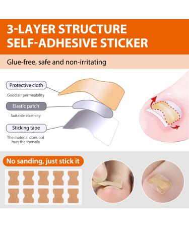 152-Piece Ingrown Toenail Tool Set | Toenail Correction Patch Clasp & Files for Pain Relief - Ship Internationally - Buy Online on SooperMarket.com