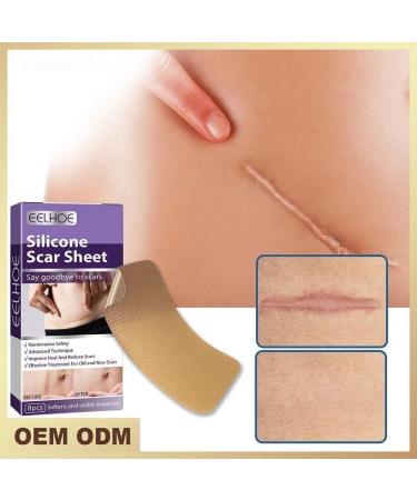 WAITLOVER Skin Color Reusable Silicone Scar Removal Patch - Surgical Self-Adhesive Soft Gel Strip for Burn Repair - Buy Online on SooperMarket.com