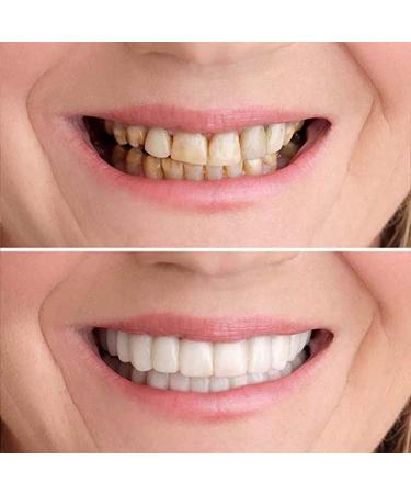 2 PCS Temporary Dentures Teeth for Women and Men - Perfect Fake Teeth to Cover Imperfections in Upper and Lower Jaw - Buy Online on SooperMarket.com