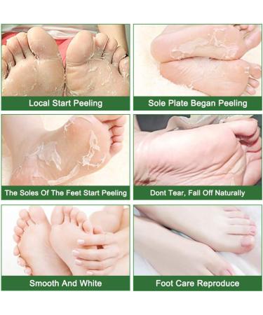 5 Pairs Tea Tree Foot Masks - Peeling Callus Remover for Soft Smooth Feet (60g 2 Pack) - Ideal for Men & Women - Buy Online on SooperMarket.com