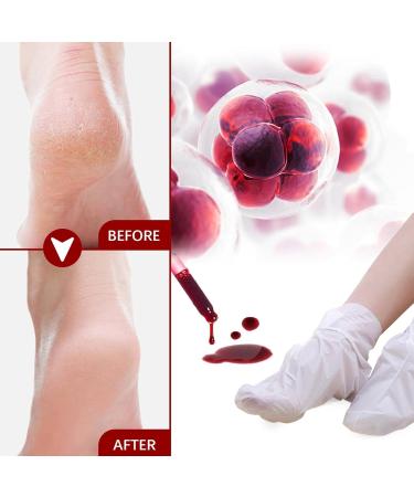 Bexdug Foot Peeling Mask - Exfoliating Peeling Socks for Soft Smooth Feet | Moisturizing Treatment & Dead Skin Remover | Heel Repair | 1 Piece - Buy Online on SooperMarket.com